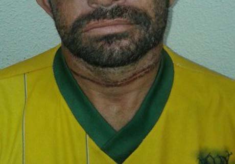 Homem é torturado e enterrado vivo no Ceará e sai de cova sozinho