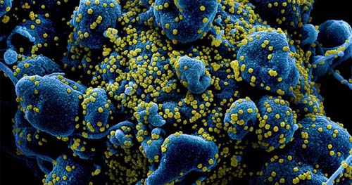 Melatonina natural produzida no pulmão pode proteger contra o coronavírus