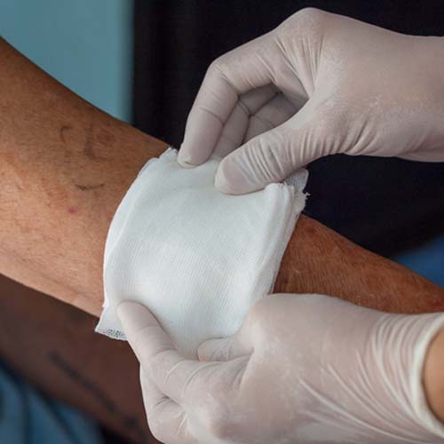 Hospital Universitário amplia atendimento após reforma no ambulatório de feridas