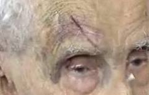 Anciã de 84 anos é agredida no olho pelo próprio filho que acaba preso