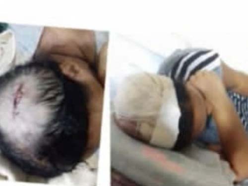 Polícia Civil segue tentando localizar jovem acusado de atacar idosa especial em Coruripe