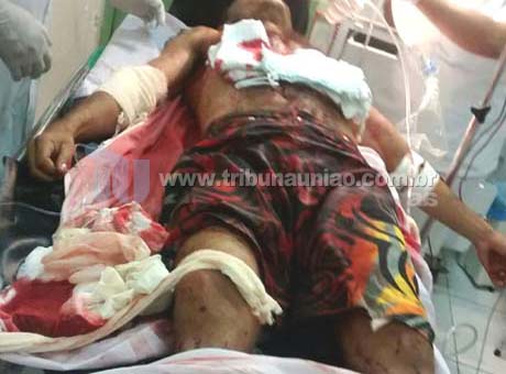 Cortador de cana é assassinado com 7 facadas na periferia de União dos Palmares