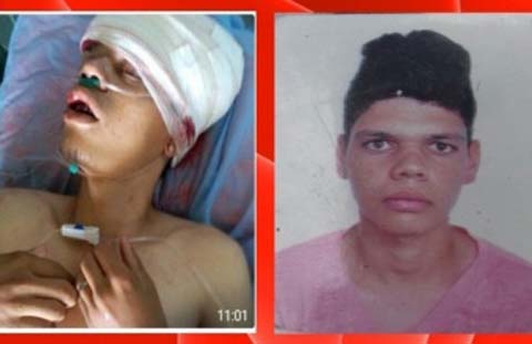 Palmeira dos Índios: morre em hospital jovem que foi espancado