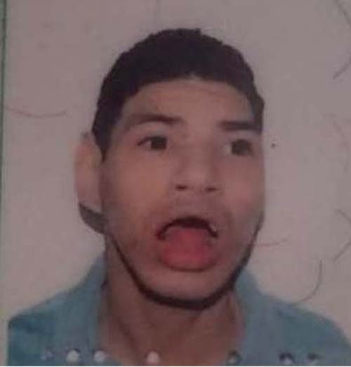 Doente mental morre carbonizado, na cama, após curto circuito em ventilador