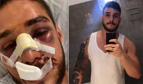 Arapiraquense que vive em Portugal é torturado por seguranças de bar em Lisboa