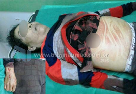 Mulher é assassinada a facadas em Santana do Mundau; ancião é morto a tiros em São José da Laje e adolescente morre vitima de 11 tiros em União
