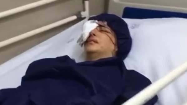 Os manifestantes iranianos cegados pela repressão: 'Atiraram no meu olho'