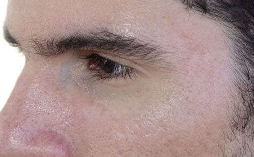 Dezembro vermelho: “O momento mais difícil para um soropositivo é a aceitação”, diz jovem sobre HIV