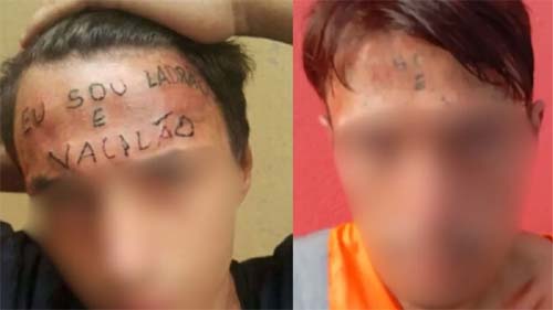 Jovem tatuado com frase pejorativa é detido após invasão a unidade de saúde