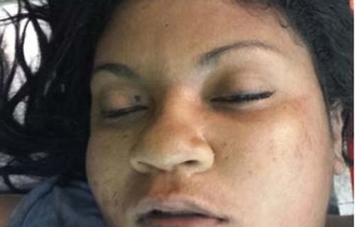 Seis pessoas são alvejadas em atentado em Lagoa da Canoa; três morrem