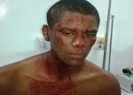 Homem é atingido por disparos de arma de fogo na cabeça e sobrevive