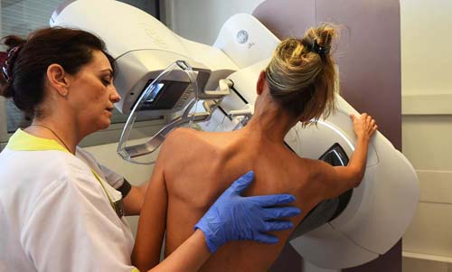 Fazer mamografia aos 40 pode reduzir risco de morte por câncer de mama em 25%