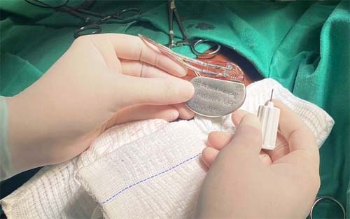 Com 38 cirurgias em 15 dias, Hospital do Coração zera fila do SUS