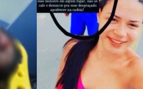 Família de jovem que teve maxilar e nariz quebrados diz que vítima foi espancada por ciúme