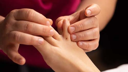 'Assassino silencioso': As zonas do corpo onde o melanoma se manifesta