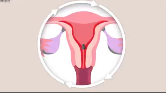 Como se produz a menstruação e por que algumas mulheres sentem mais dor que outras