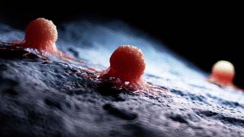 O ingrediente (muito comum) que aumenta o risco de metástases