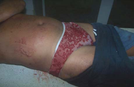 Homem usando calcinha é assassinado com vários tiros em Pariconha 
