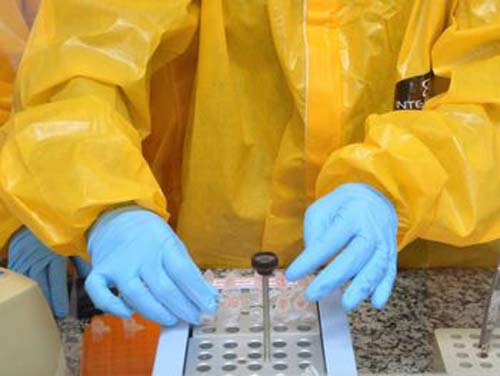 Jovens entre 20 e 29 anos saudáveis morreram mais de Covid-19 em AL que os dos grupos de risco