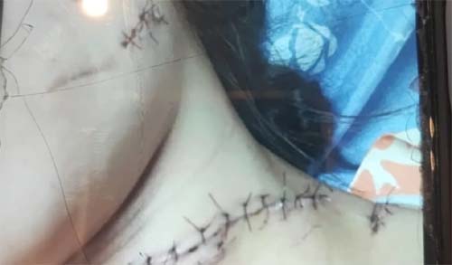 Homem é detido após invasão e ataque com faca contra ex-companheira em Maceió