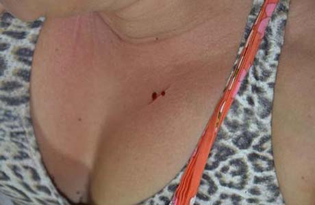 Funcionaria de hospital é esfaqueada em Marechal Deodoro