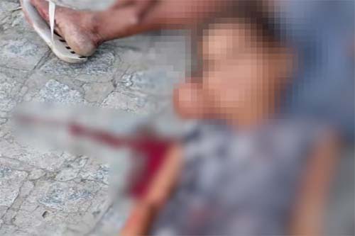 Mulher fica ensanguentada após ter pulso cortado em via pública; marido é principal suspeito