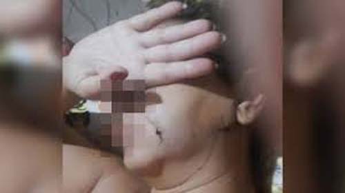 Mulher fica com faca cravada no pescoço após tentativa de feminicídio em Nova Iguaçu