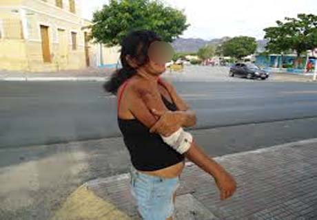Mulher é esfaqueada no braço e na testa no bairro do Bom Parto