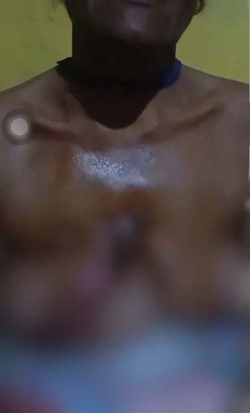 Polícia apura caso de violência extrema contra mulher em Mata Grande