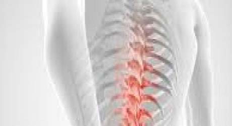 Dia Mundial da Osteoporose alerta para perigo da doença entre homens