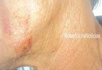 Homem é preso acusado de espancar o própio pai