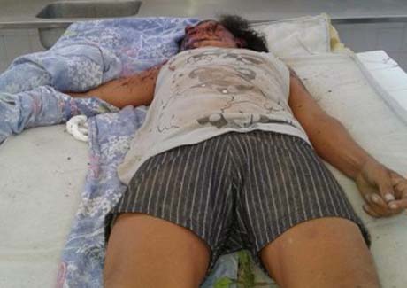 Mata Grande: corpo de mulher é encontrado em estrada vicinal