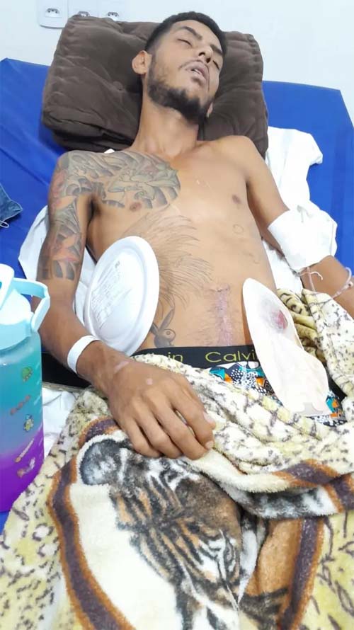 Jovem há Dois Anos na Espera de Cirurgia Crucial Após Sobrevivência a Ato Violento