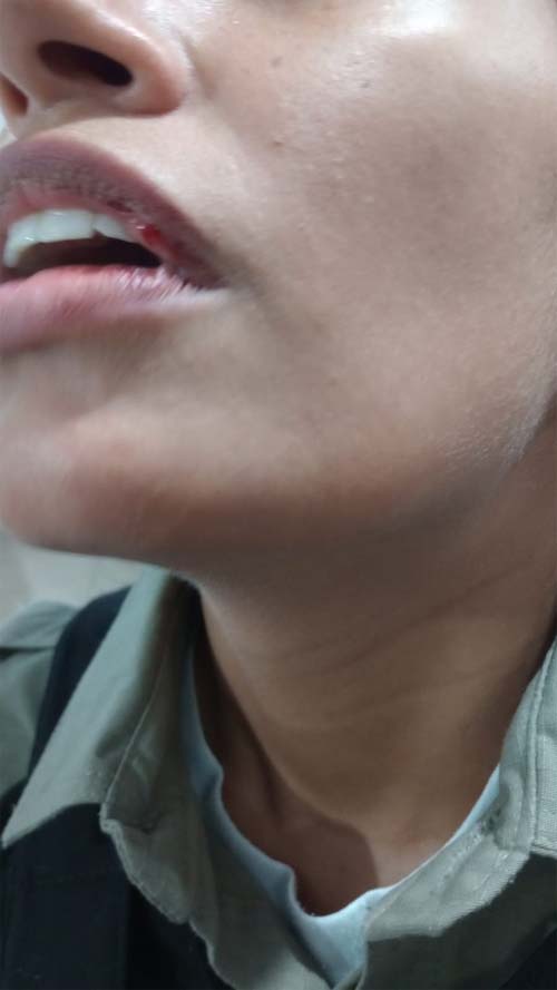 Policial Militar é agredida ao atender ocorrência de som alto