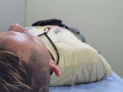 Práticas integrativas proporcionam prevenção e tratamento de doenças