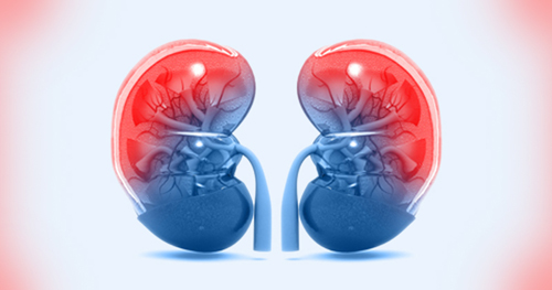 Poluição atmosférica influencia em casos de doenças renais, aponta estudo