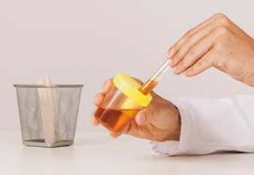 Sangue na urina: o que pode ser?