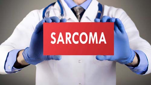 5 coisas que você precisa saber sobre sarcomas