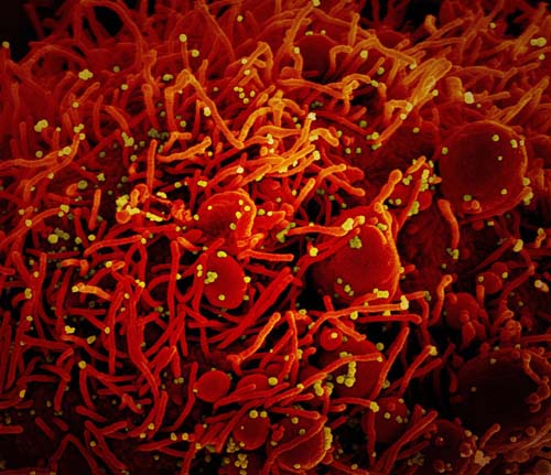 Os mistérios do SARS-CoV-2, um bicho perverso