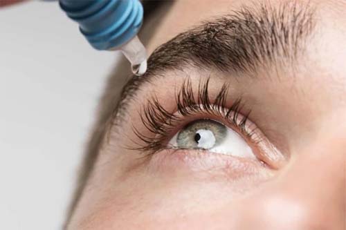 Aumento de Problemas Oculares em Brasília Durante Período de Baixa Umidade