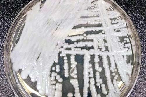 São Paulo confirma 1° caso de contaminação por superfungo