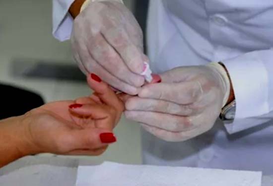 Teste rápido para HIV será promovido pela Sesau neste sábado (28)