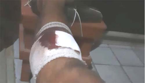 Jovem desacata ordem policial e é atingido por um bala de borracha, em Porto Calvo