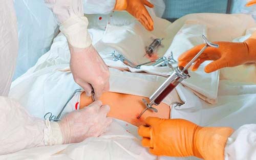 Pandemia reduz número de doações de órgãos, tecidos e medula no país; veja filas de espera em AL