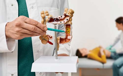 Alagoas tem 430 casos de câncer colorretal