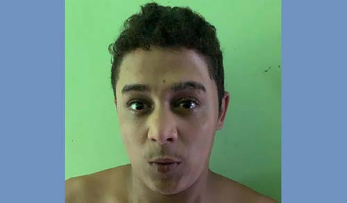 Jovem de 21 anos é morto com disparos de arma de fogo em Arapiraca