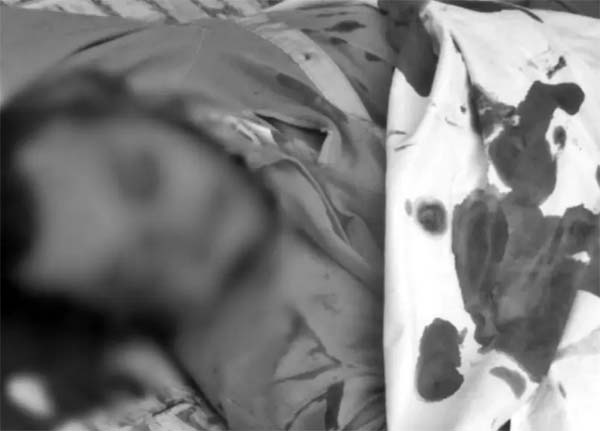 Homem é alvejado a tiros na parte alta de São Miguel dos Campos