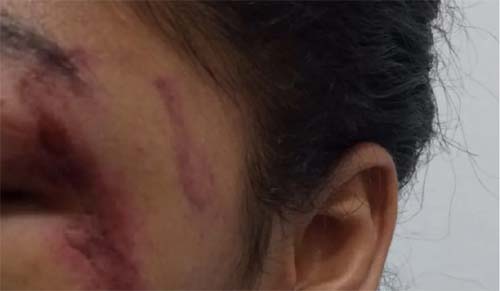 Duas vezes vítimas: mulheres sofreram agressões durante quarentena imposta pela pandemia